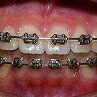 Close Up Pics answers and cheats level 14-8